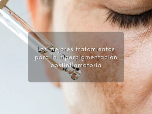 Los mejores tratamientos para la hiperpigmentación postinflamatoria