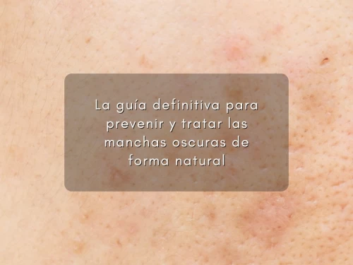 La guía definitiva para prevenir y tratar las manchas oscuras de forma natural